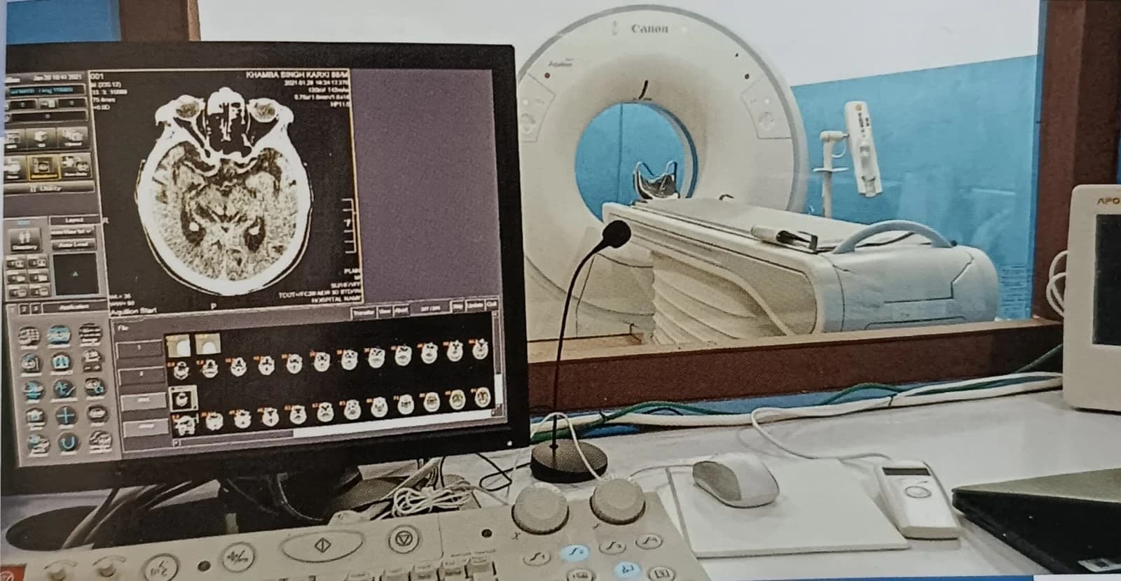 Multi-slice CT Scan with Peripheral Angiogram